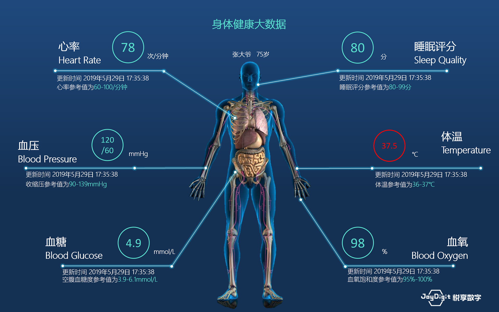 消費(fèi)日?qǐng)?bào)：悅享數(shù)字推動(dòng)新興技術(shù)與養(yǎng)老服務(wù)相結(jié)合，加快養(yǎng)老行業(yè)數(shù)字化轉(zhuǎn)型(圖9)